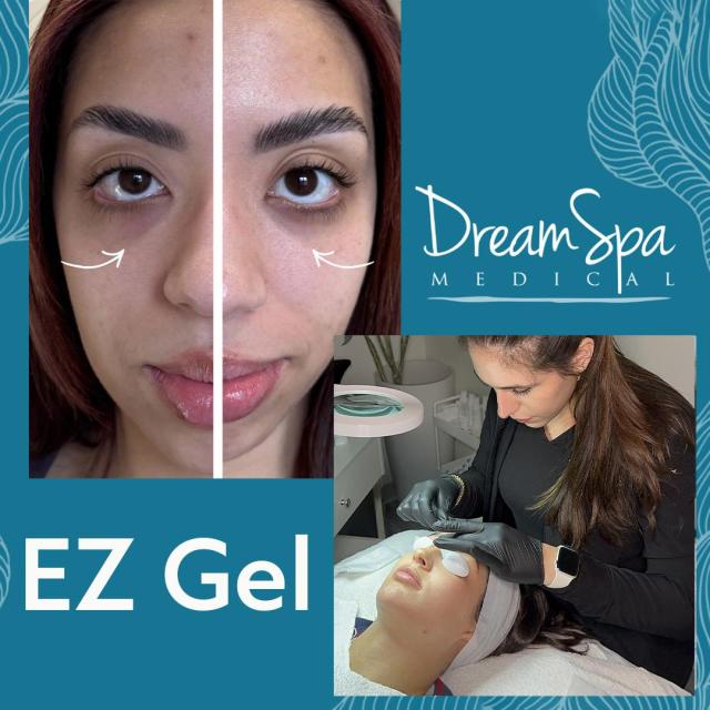 20% Off EZ Gel