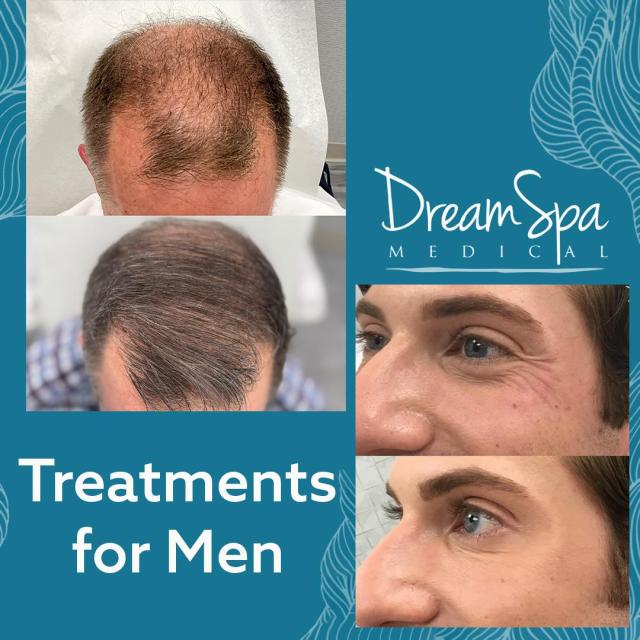 Treatments for Men