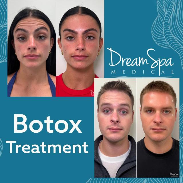 Botox – $50 Off Your First Treatment